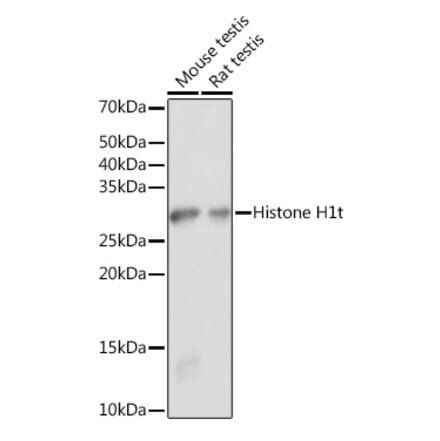 Western Blot - Anti-Histone H1 Antibody (A305473) - Antibodies.com