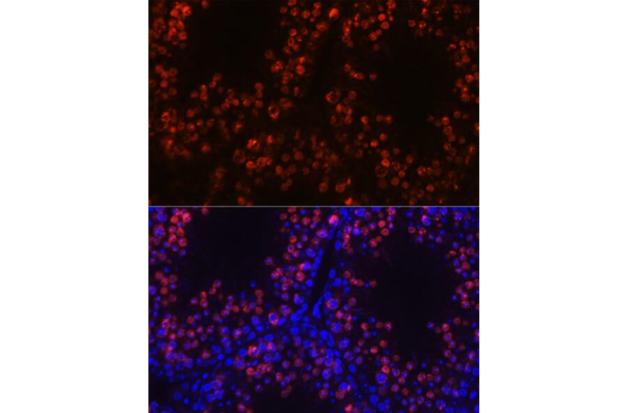 Immunofluorescence - Anti-Histone H1 Antibody (A305473) - Antibodies.com