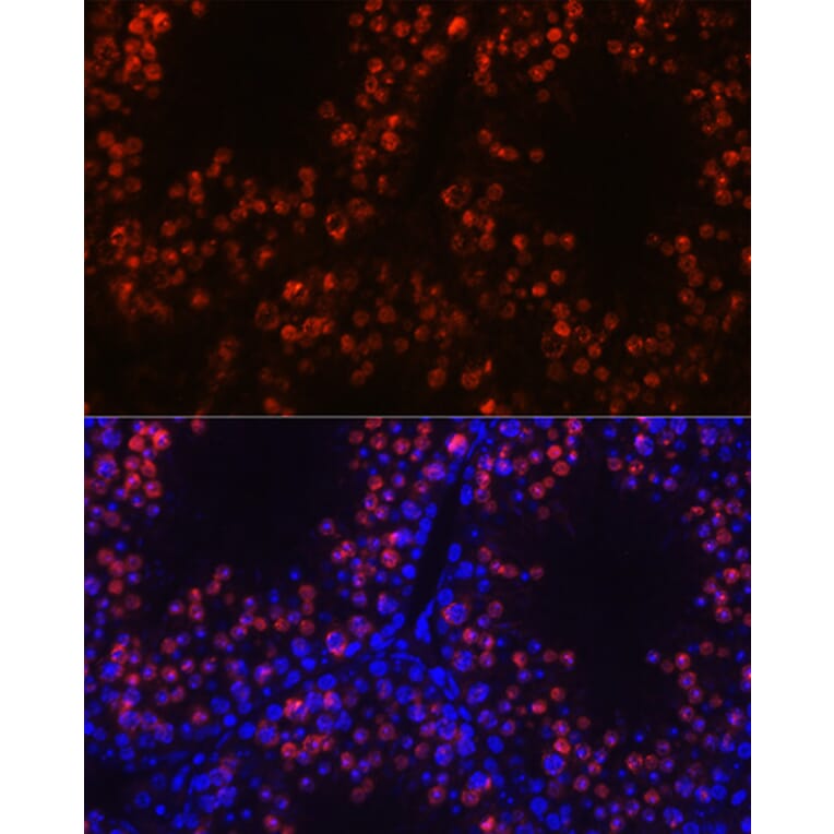 Immunofluorescence - Anti-Histone H1 Antibody (A305473) - Antibodies.com