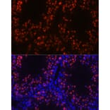 Immunofluorescence - Anti-Histone H1 Antibody (A305473) - Antibodies.com