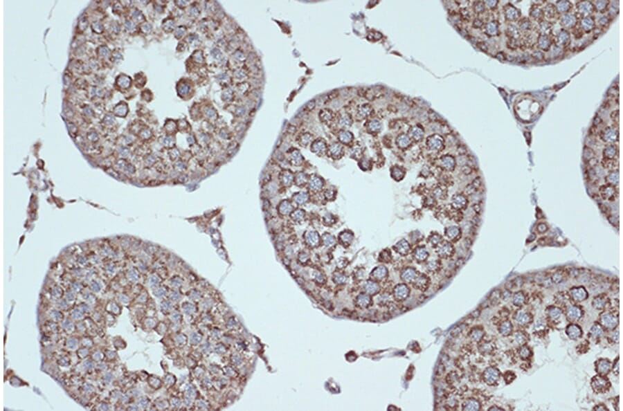 Immunohistochemistry - Anti-Smac/Diablo Antibody [ARC1340] (A305474) - Antibodies.com