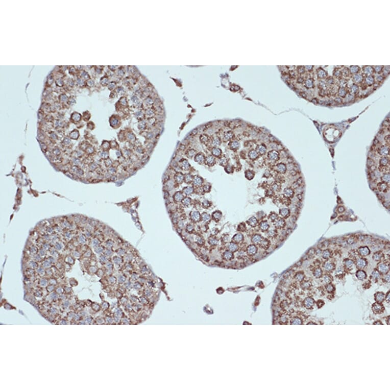 Immunohistochemistry - Anti-Smac/Diablo Antibody [ARC1340] (A305474) - Antibodies.com