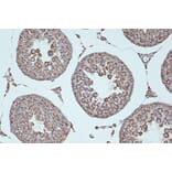 Immunohistochemistry - Anti-Smac/Diablo Antibody [ARC1340] (A305474) - Antibodies.com