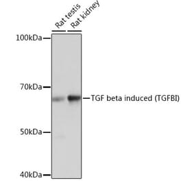 Western Blot - Anti-TGFBI Antibody [ARC0757] (A305475) - Antibodies.com
