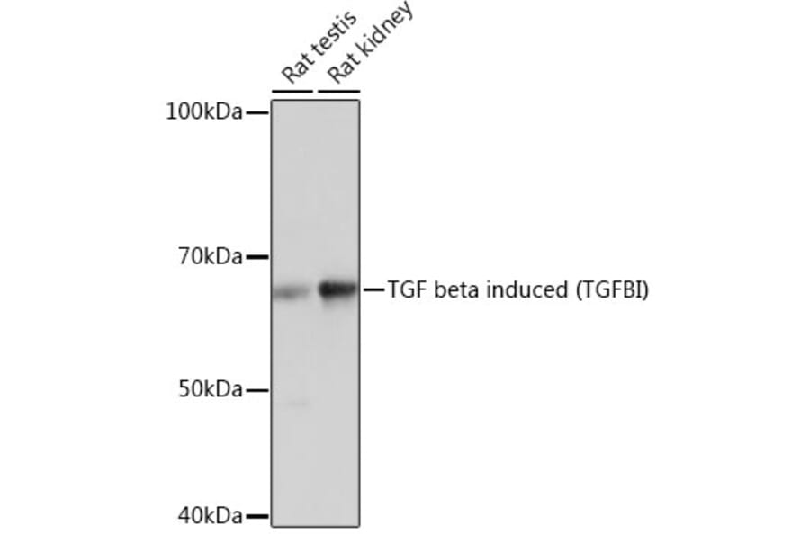 Western Blot - Anti-TGFBI Antibody [ARC0757] (A305475) - Antibodies.com
