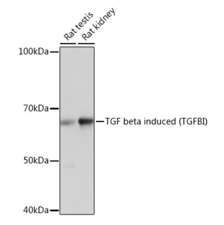 Western Blot - Anti-TGFBI Antibody [ARC0757] (A305475) - Antibodies.com