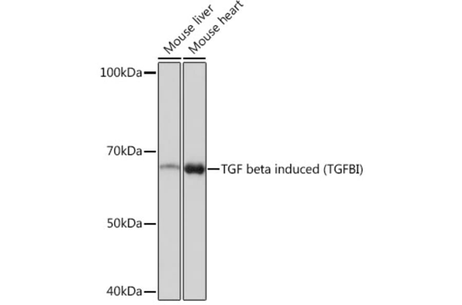 Western Blot - Anti-TGFBI Antibody [ARC0757] (A305475) - Antibodies.com