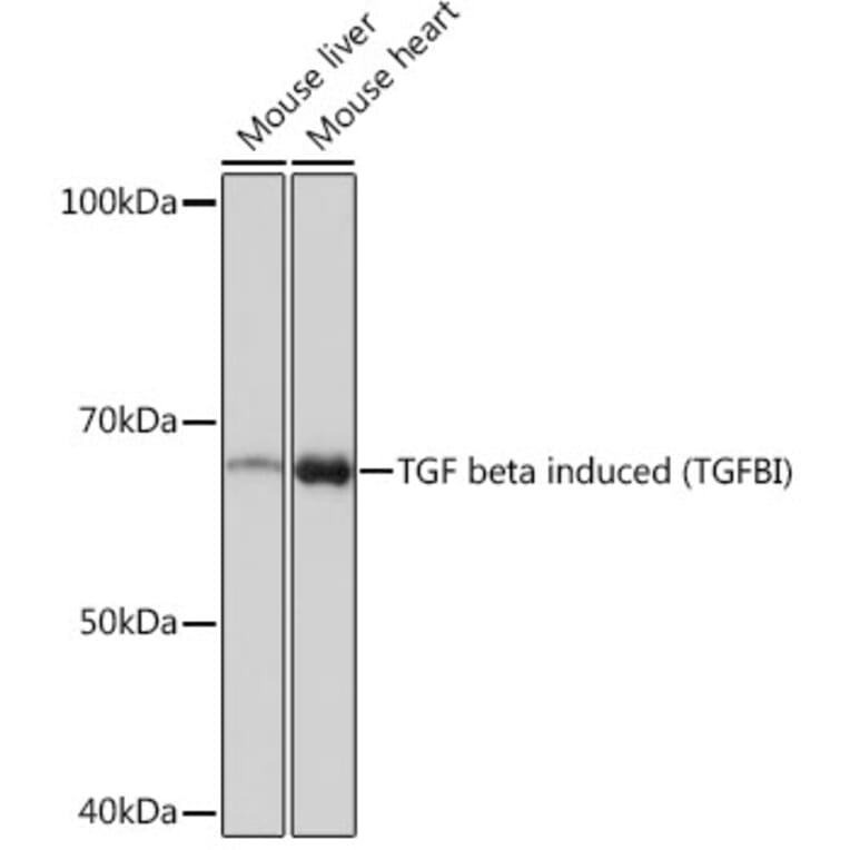 Western Blot - Anti-TGFBI Antibody [ARC0757] (A305475) - Antibodies.com