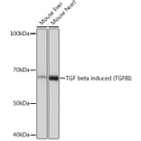 Western Blot - Anti-TGFBI Antibody [ARC0757] (A305475) - Antibodies.com
