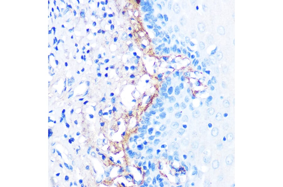 Immunohistochemistry - Anti-TGFBI Antibody [ARC0757] (A305475) - Antibodies.com