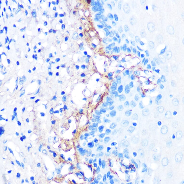 Immunohistochemistry - Anti-TGFBI Antibody [ARC0757] (A305475) - Antibodies.com