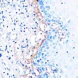 Immunohistochemistry - Anti-TGFBI Antibody [ARC0757] (A305475) - Antibodies.com