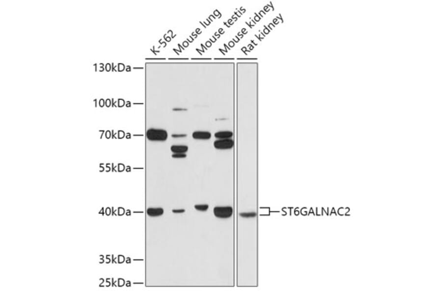 Western Blot - Anti-ST6GALNAC2 Antibody (A305476) - Antibodies.com