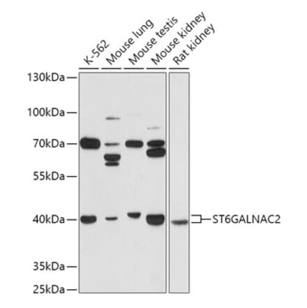 Western Blot - Anti-ST6GALNAC2 Antibody (A305476) - Antibodies.com