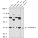 Western Blot - Anti-ST6GALNAC2 Antibody (A305476) - Antibodies.com