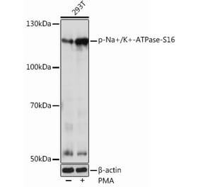 Western Blot - Anti-Sodium Potassium ATPase (phospho Ser16) Antibody (A305477) - Antibodies.com