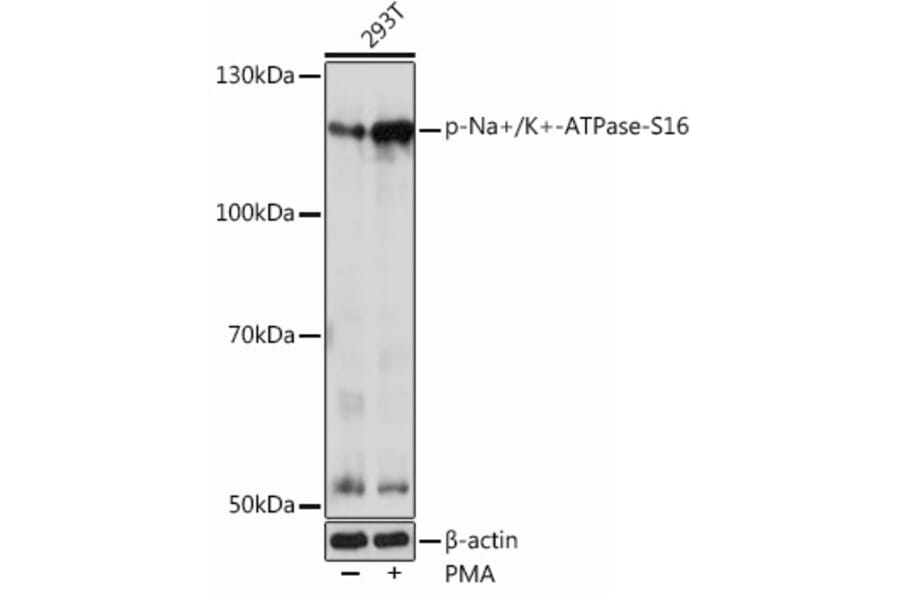 Western Blot - Anti-Sodium Potassium ATPase (phospho Ser16) Antibody (A305477) - Antibodies.com