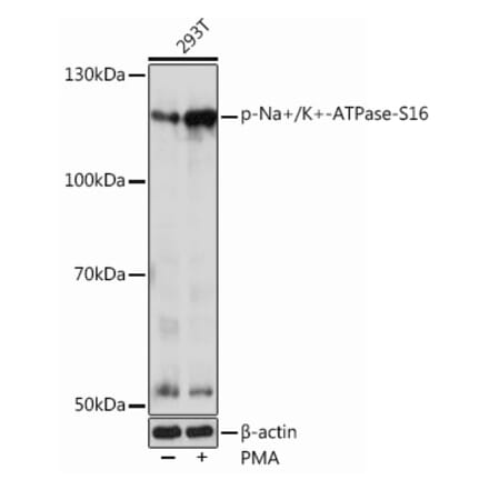 Western Blot - Anti-Sodium Potassium ATPase (phospho Ser16) Antibody (A305477) - Antibodies.com