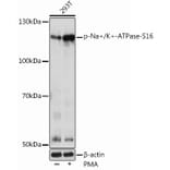 Western Blot - Anti-Sodium Potassium ATPase (phospho Ser16) Antibody (A305477) - Antibodies.com
