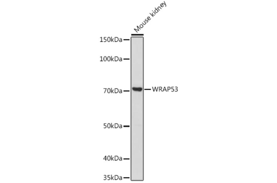 Western Blot - Anti-WDR79 Antibody (A305478) - Antibodies.com