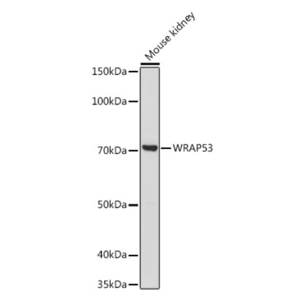 Western Blot - Anti-WDR79 Antibody (A305478) - Antibodies.com