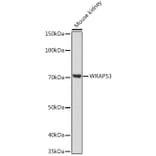 Western Blot - Anti-WDR79 Antibody (A305478) - Antibodies.com