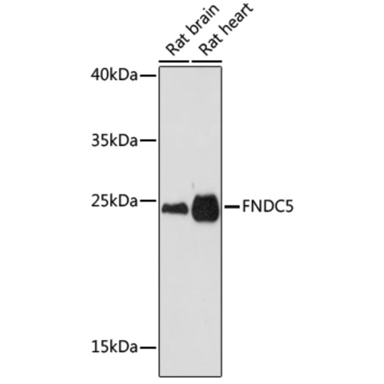 Western Blot - Anti-FNDC5 Antibody (A305480) - Antibodies.com