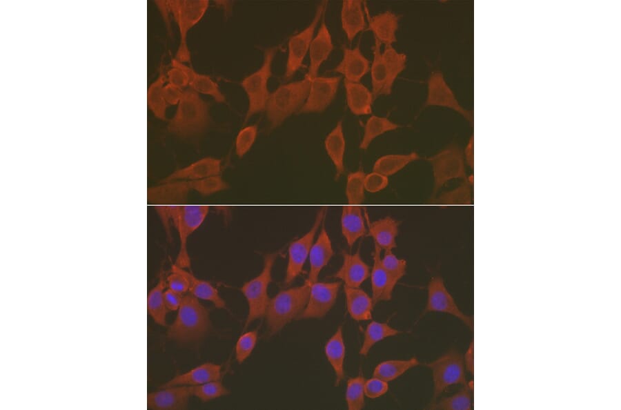 Immunofluorescence - Anti-FNDC5 Antibody (A305480) - Antibodies.com