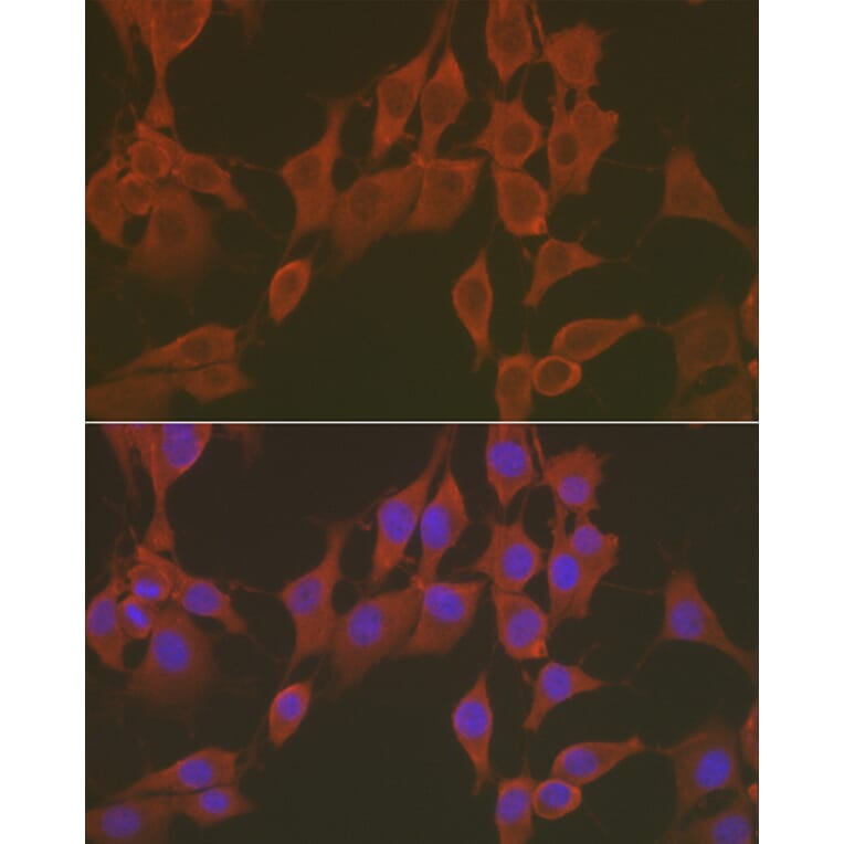 Immunofluorescence - Anti-FNDC5 Antibody (A305480) - Antibodies.com