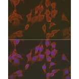 Immunofluorescence - Anti-FNDC5 Antibody (A305480) - Antibodies.com