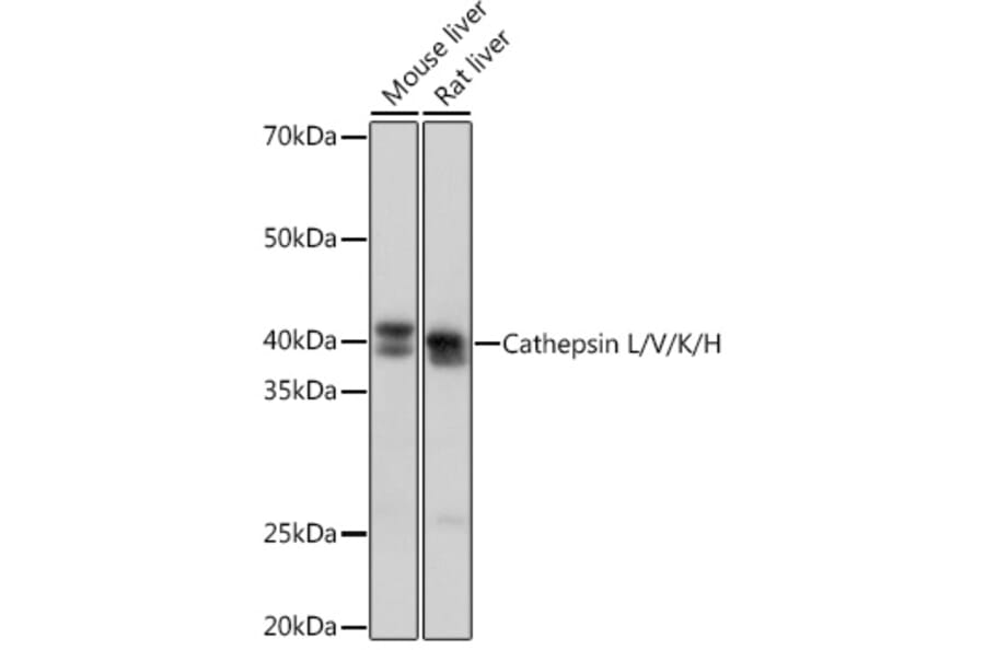 Western Blot - Anti-Cathepsin L/V/K/H Antibody [ARC1276] (A305481) - Antibodies.com