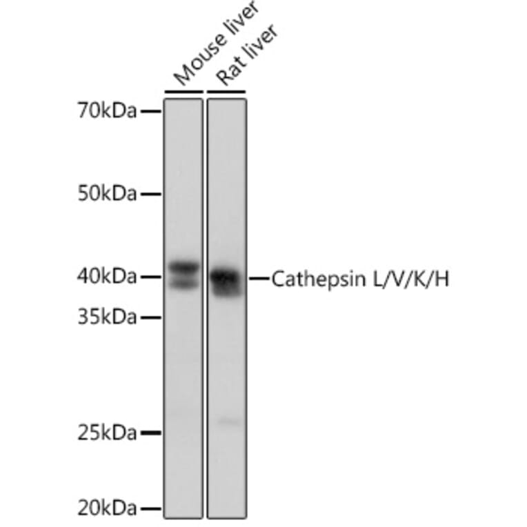 Western Blot - Anti-Cathepsin L/V/K/H Antibody [ARC1276] (A305481) - Antibodies.com