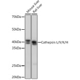Western Blot - Anti-Cathepsin L/V/K/H Antibody [ARC1276] (A305481) - Antibodies.com