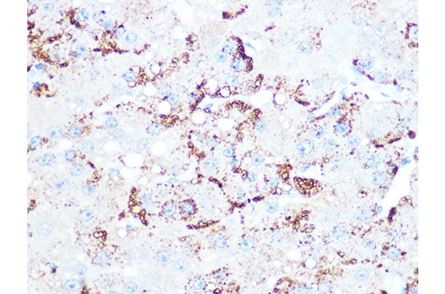 Immunohistochemistry - Anti-Cathepsin L/V/K/H Antibody [ARC1276] (A305481) - Antibodies.com