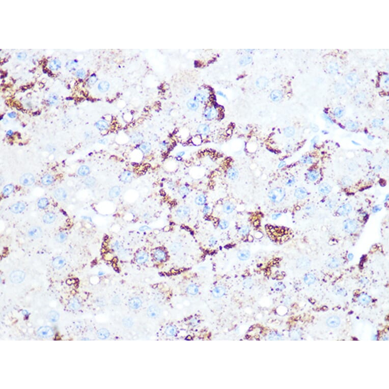 Immunohistochemistry - Anti-Cathepsin L/V/K/H Antibody [ARC1276] (A305481) - Antibodies.com