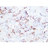 Immunohistochemistry - Anti-Cathepsin L/V/K/H Antibody [ARC1276] (A305481) - Antibodies.com