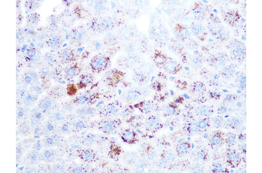 Immunohistochemistry - Anti-Cathepsin L/V/K/H Antibody [ARC1276] (A305481) - Antibodies.com