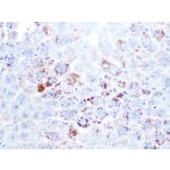 Immunohistochemistry - Anti-Cathepsin L/V/K/H Antibody [ARC1276] (A305481) - Antibodies.com