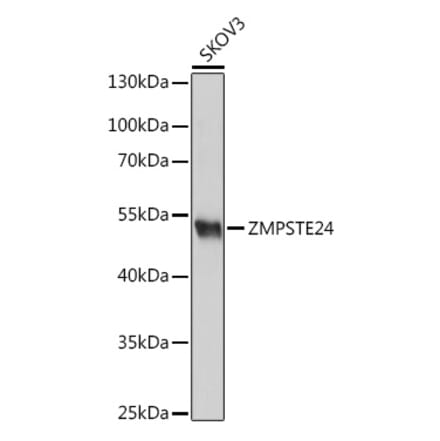Western Blot - Anti-ZMPSTE24 Antibody (A305482) - Antibodies.com