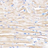 Immunohistochemistry - Anti-ZMPSTE24 Antibody (A305482) - Antibodies.com