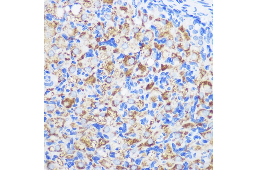 Immunohistochemistry - Anti-ZMPSTE24 Antibody (A305482) - Antibodies.com