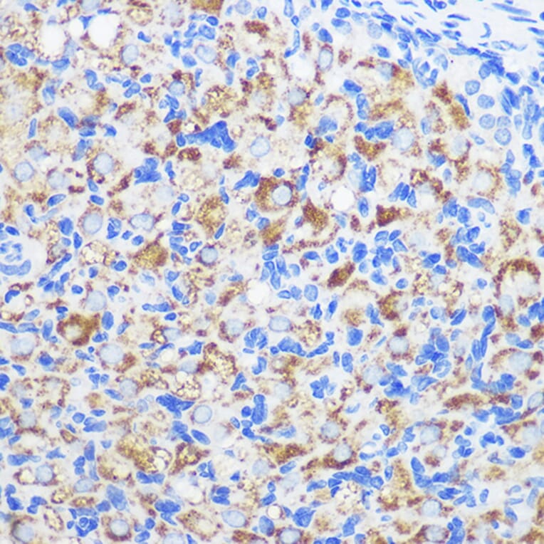 Immunohistochemistry - Anti-ZMPSTE24 Antibody (A305482) - Antibodies.com