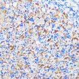 Immunohistochemistry - Anti-ZMPSTE24 Antibody (A305482) - Antibodies.com