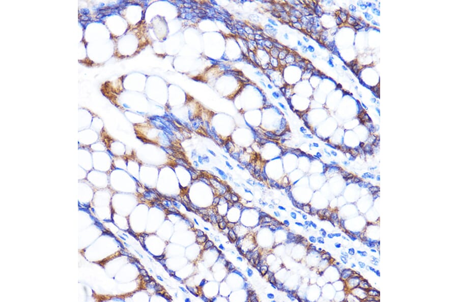 Immunohistochemistry - Anti-ZMPSTE24 Antibody (A305482) - Antibodies.com