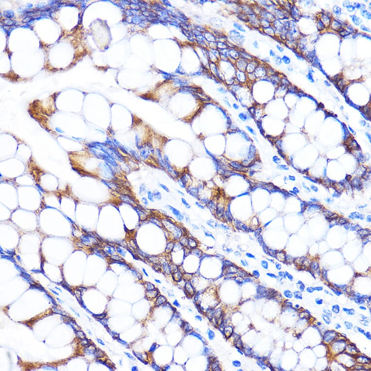 Immunohistochemistry - Anti-ZMPSTE24 Antibody (A305482) - Antibodies.com