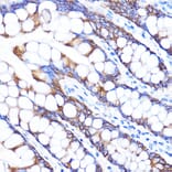 Immunohistochemistry - Anti-ZMPSTE24 Antibody (A305482) - Antibodies.com