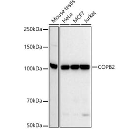 Western Blot - Anti-COPB2 Antibody [ARC52626] (A305485) - Antibodies.com