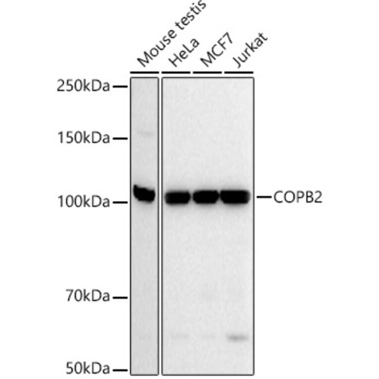 Western Blot - Anti-COPB2 Antibody [ARC52626] (A305485) - Antibodies.com