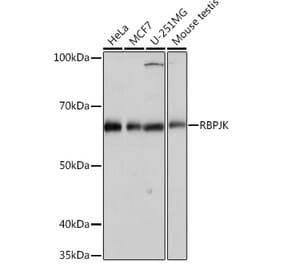 Western Blot - Anti-RBPJK Antibody [ARC0894] (A305486) - Antibodies.com