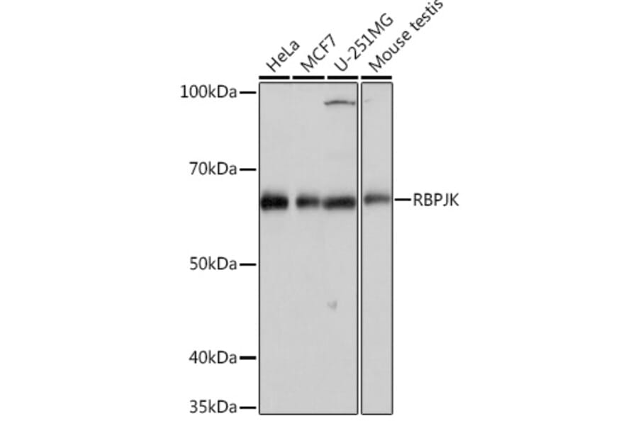 Western Blot - Anti-RBPJK Antibody [ARC0894] (A305486) - Antibodies.com